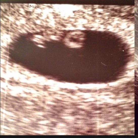 baby.JPG